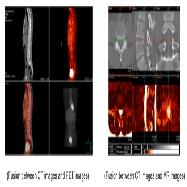 Medical Software : Vfusion