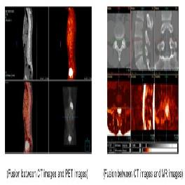 Medical Software : Vfusion